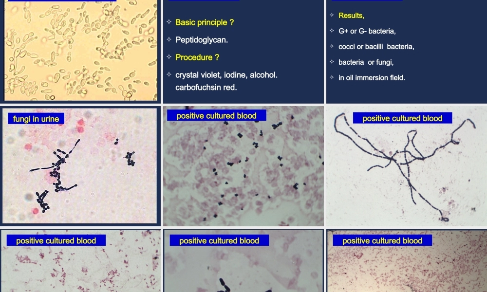 c1临床微生物检查(1).ppt