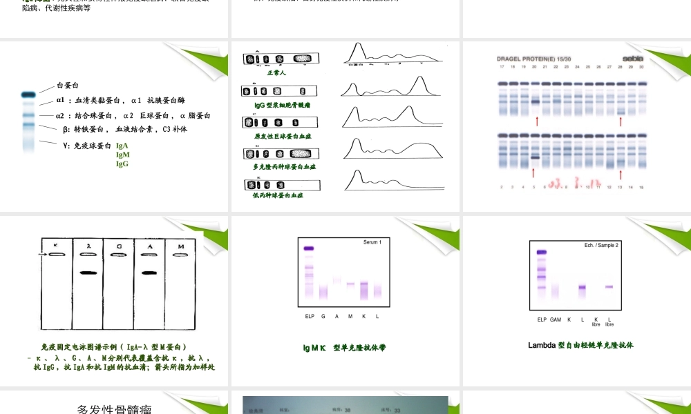 b5体液、感染免疫检查.ppt