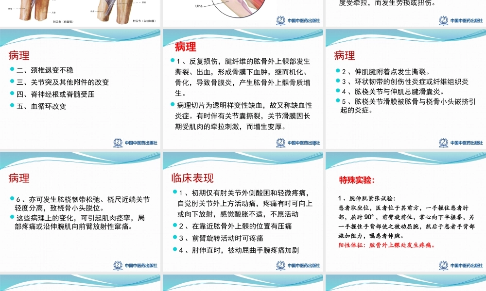 2.4肱骨外上髁炎.pptx