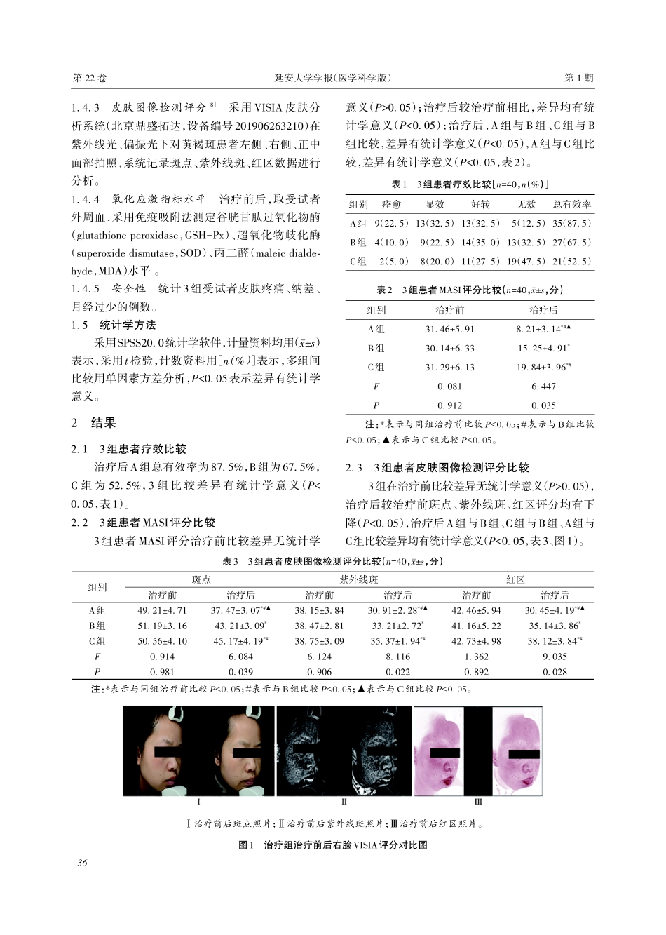 基于滋水涵木法联合导入不同浓度的氨甲环酸溶液治疗女性黄褐斑疗效评价.pdf_第3页