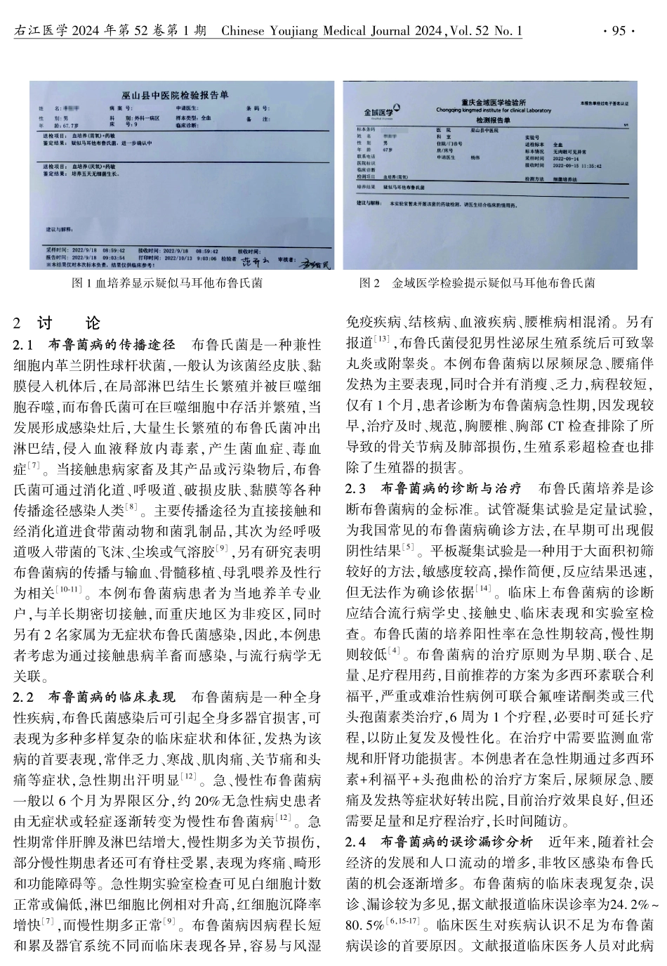 以尿频尿急及腰痛伴发热为表现的布鲁菌病1例报道.pdf_第2页