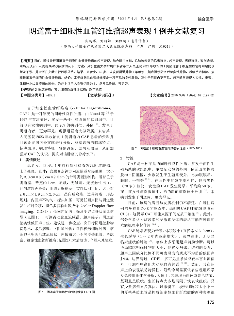 阴道富于细胞性血管纤维瘤超声表现1例并文献复习.pdf_第1页