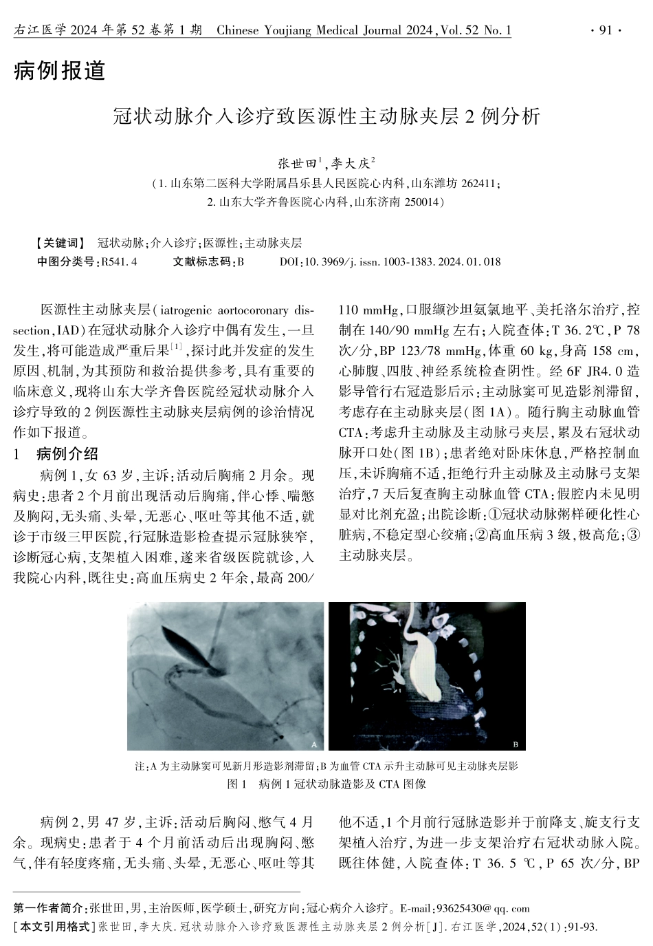 冠状动脉介入诊疗致医源性主动脉夹层2例分析.pdf_第1页