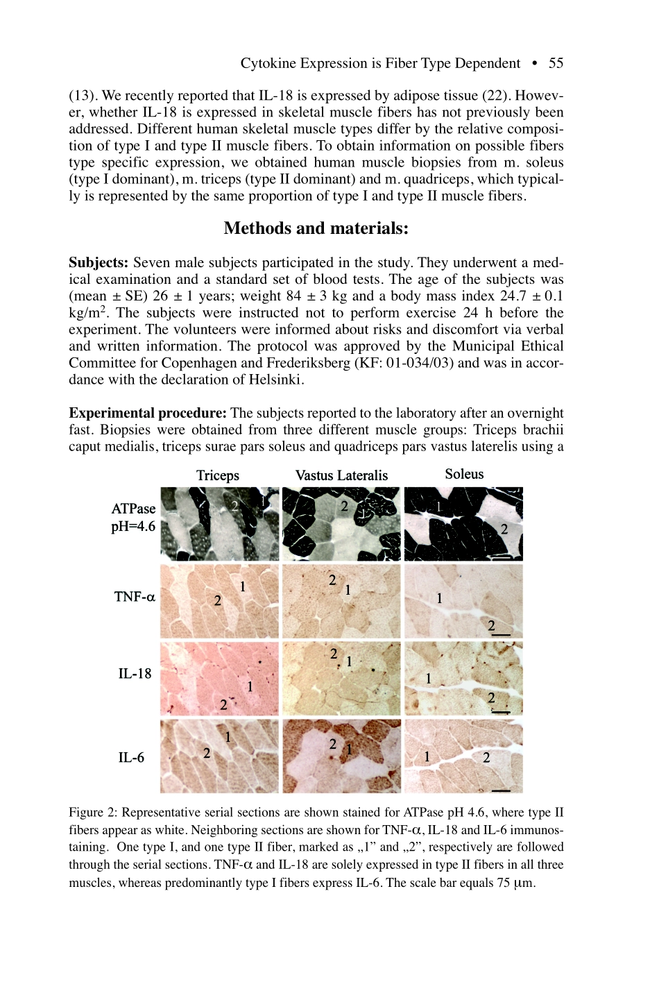 Fiber type specific expression of TNF-alpha,IL-6 and IL-18(1).pdf_第3页
