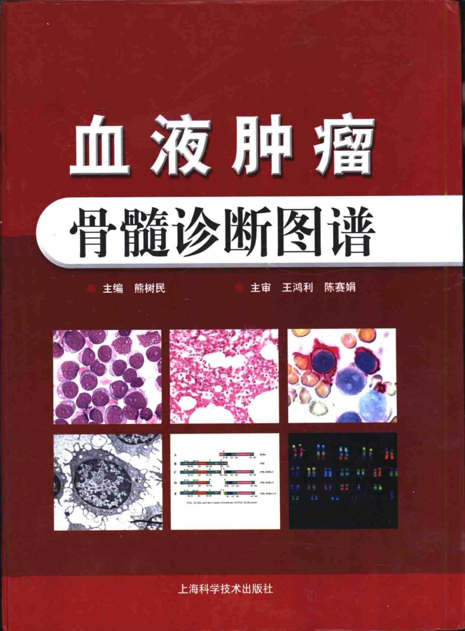 血液肿瘤骨髓诊断图谱(1).pdf_第1页