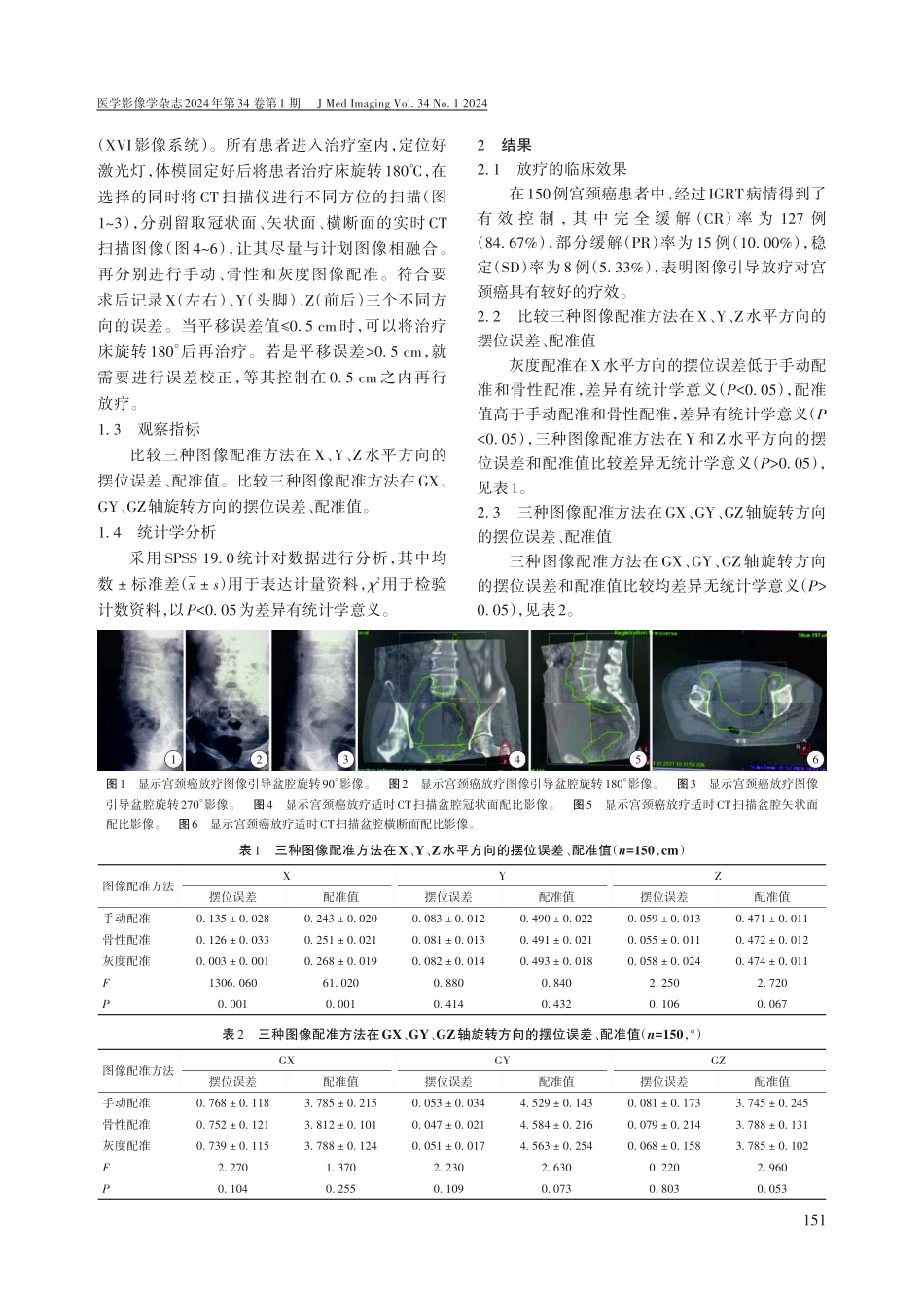 宫颈癌图像引导放疗技术在不同图像配准方法的应用价值.pdf_第2页