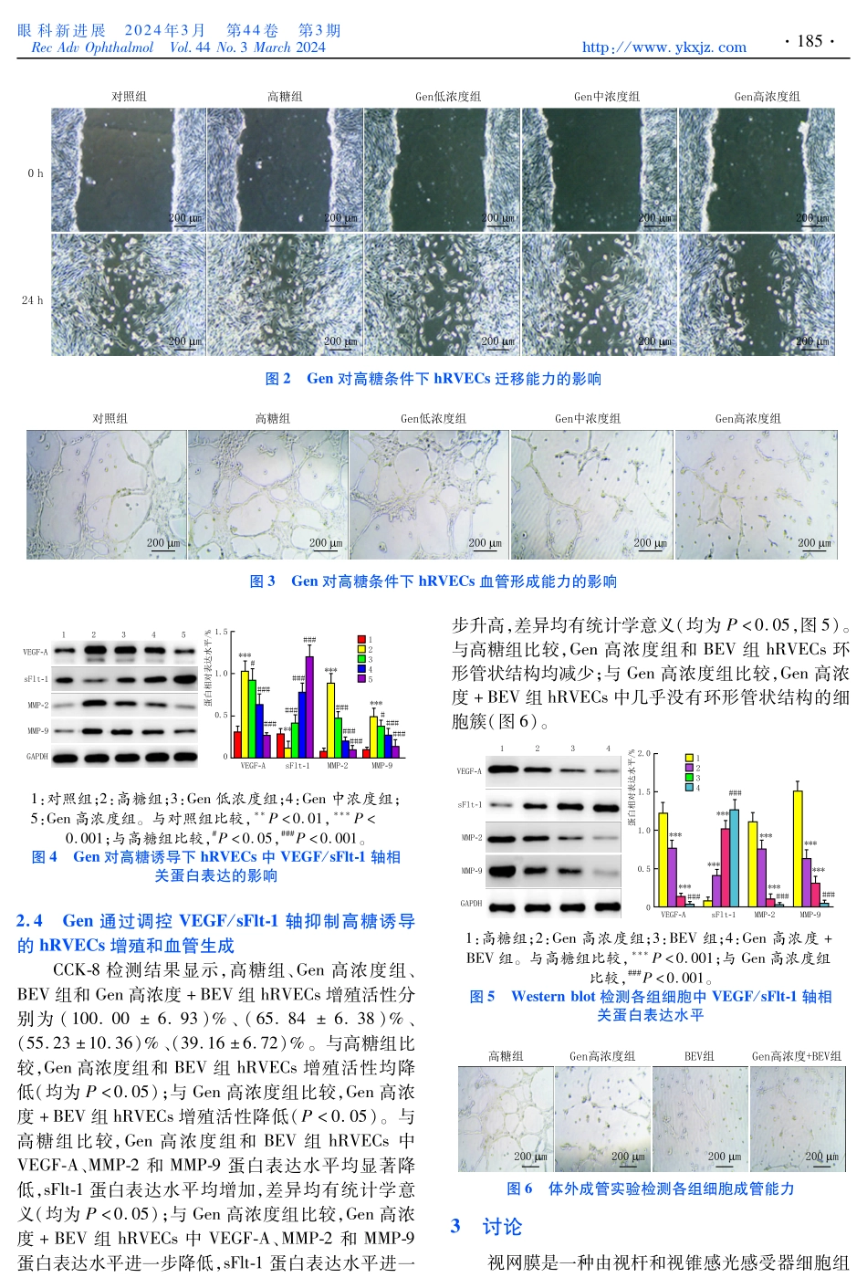 京尼平苷对高糖诱导的人视网膜血管内皮细胞增殖及血管生成的影响及机制研究.pdf_第3页