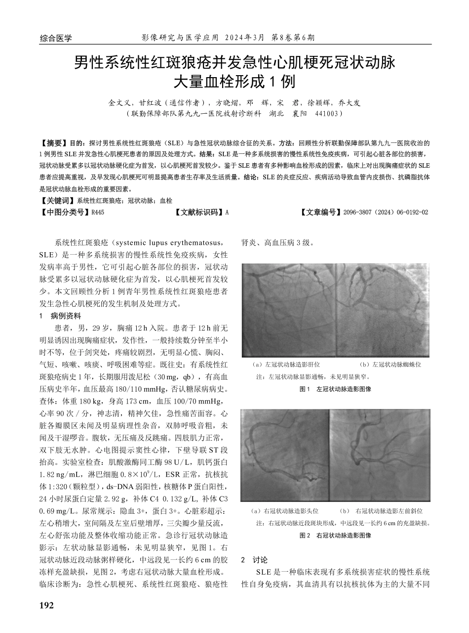 男性系统性红斑狼疮并发急性心肌梗死冠状动脉大量血栓形成1例.pdf_第1页