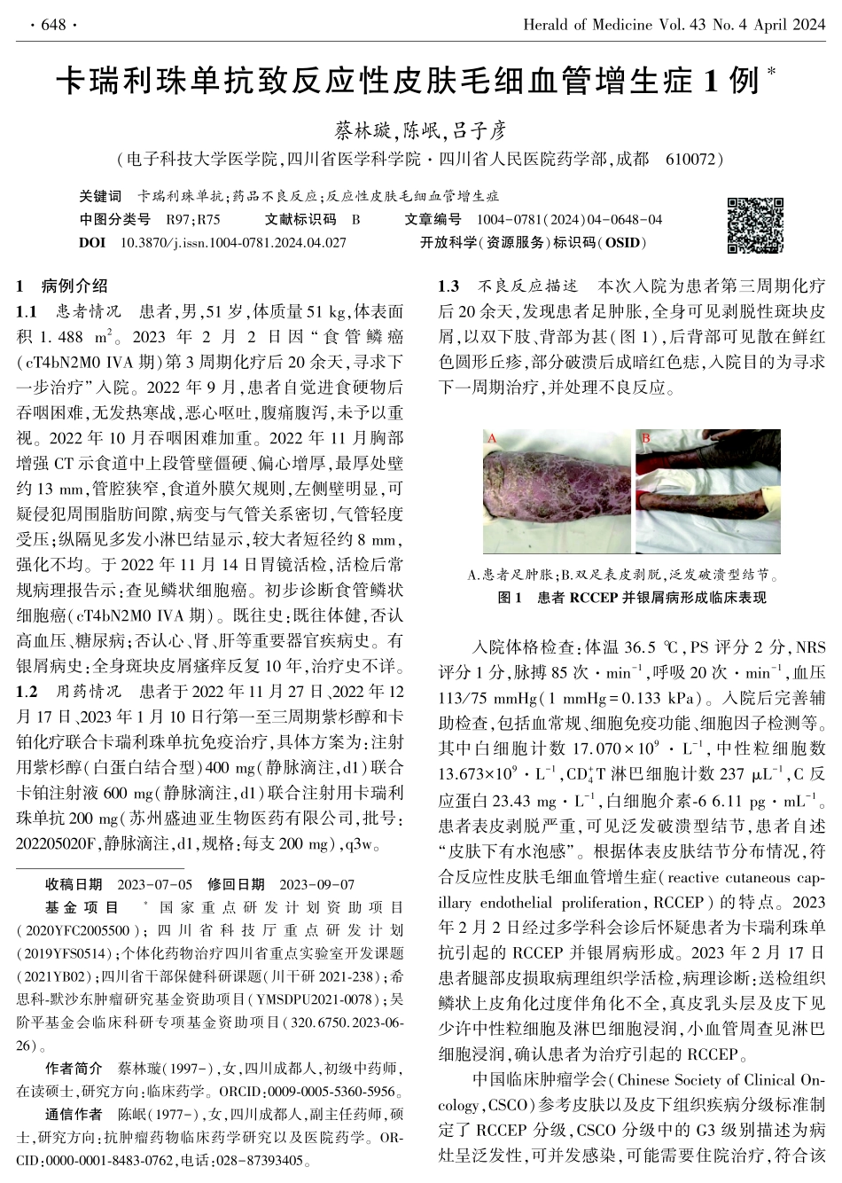 卡瑞利珠单抗致反应性皮肤毛细血管增生症1例.pdf_第1页