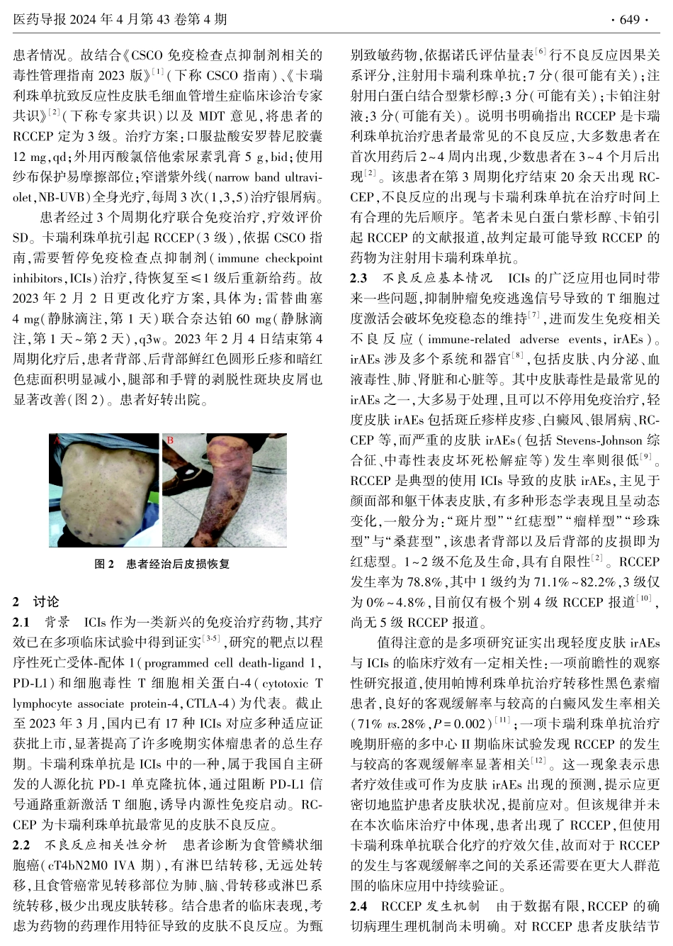 卡瑞利珠单抗致反应性皮肤毛细血管增生症1例.pdf_第2页