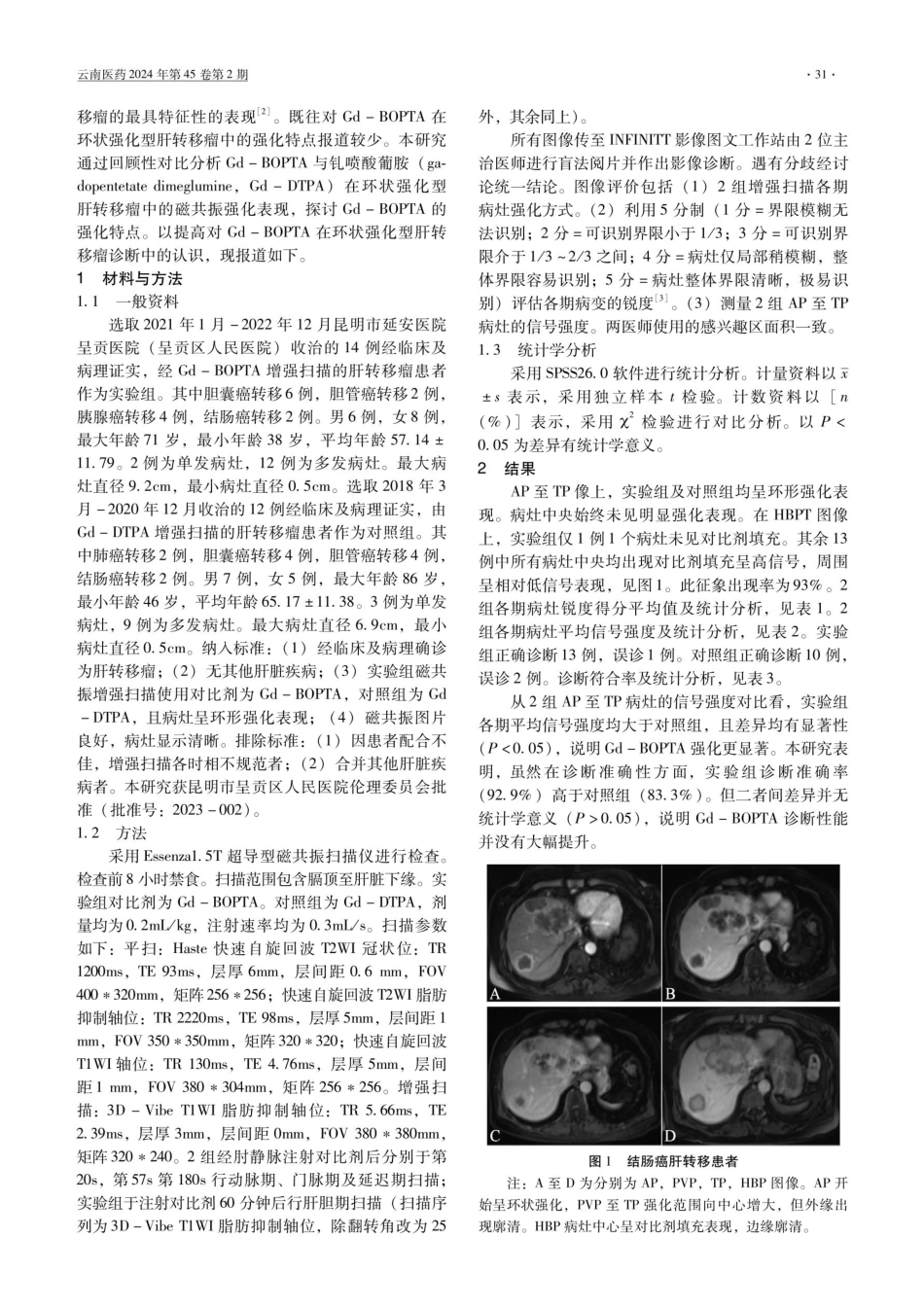 莫迪司诊断肝转移瘤的应用分析.pdf_第2页