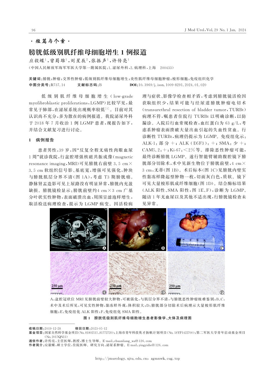膀胱低级别肌纤维母细胞增生1例报道.pdf_第1页