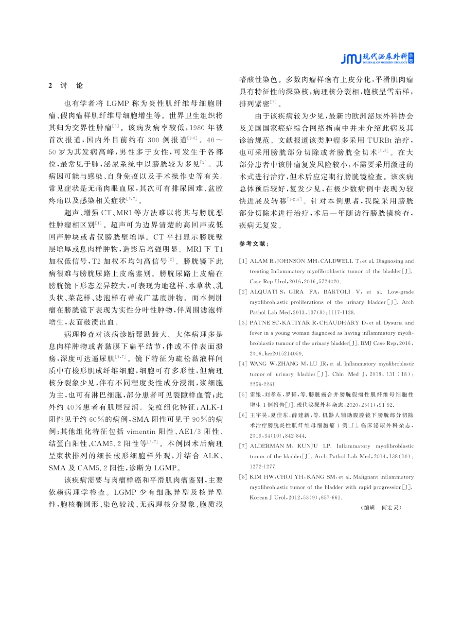 膀胱低级别肌纤维母细胞增生1例报道.pdf_第2页