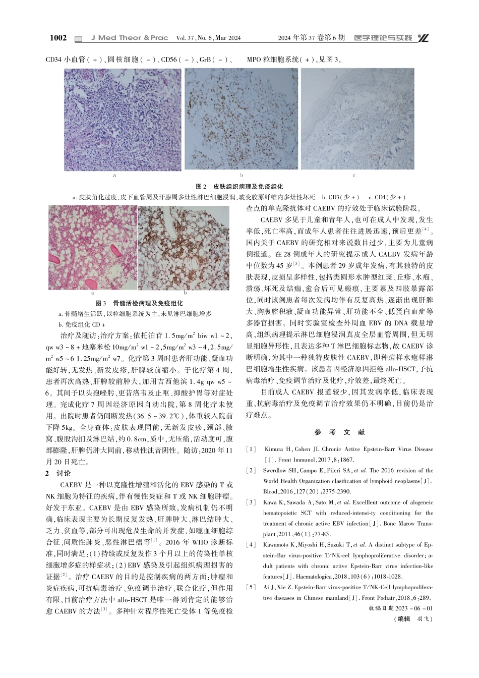 成人慢性活动性EB病毒感染1例.pdf_第2页