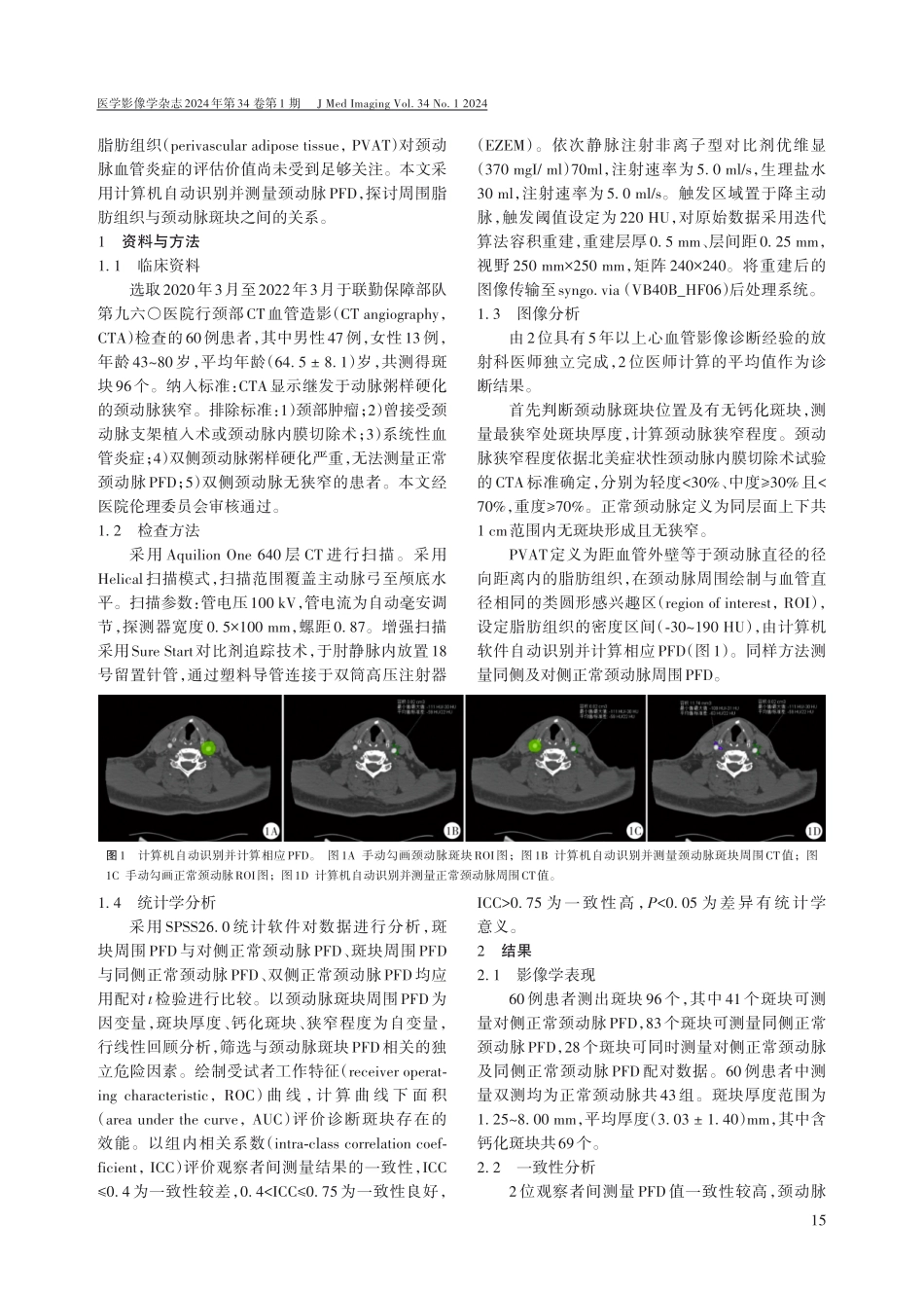 计算机辅助测量颈动脉周围脂肪密度与颈动脉斑块的关系.pdf_第2页