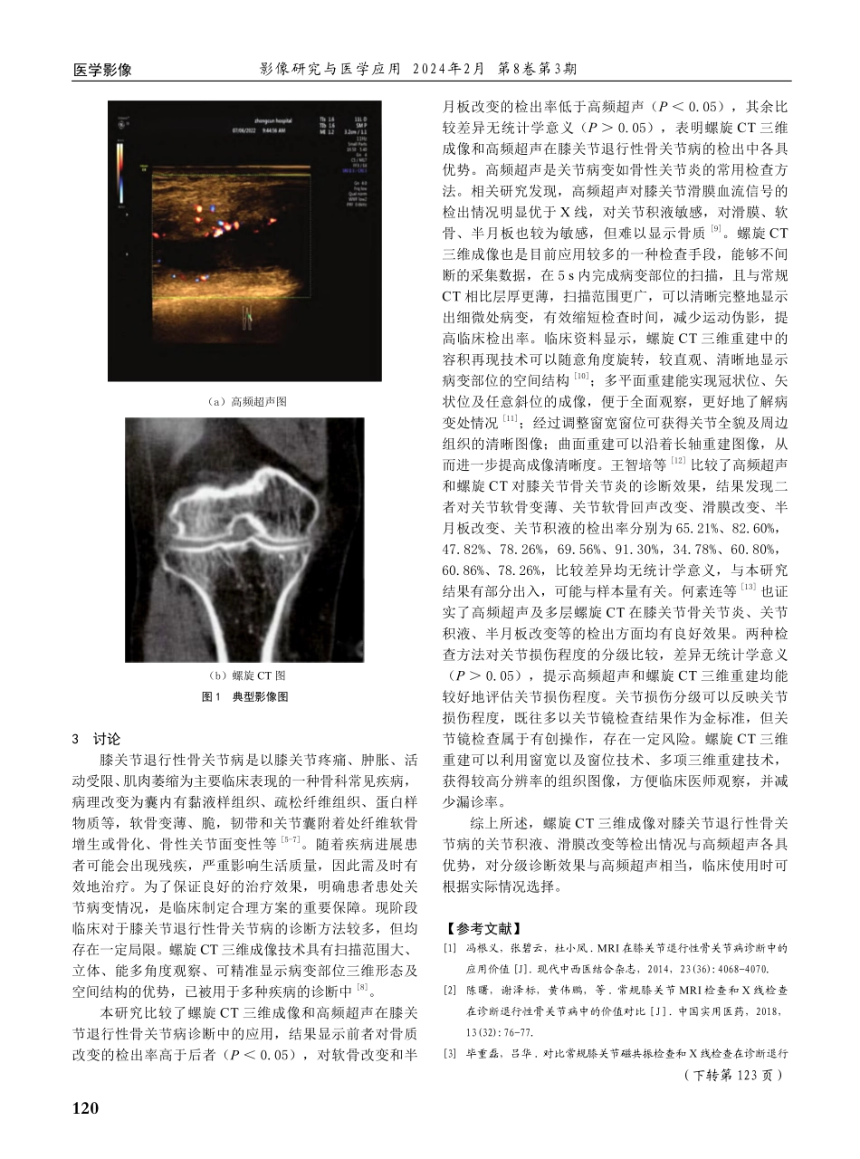 螺旋CT三维成像对膝关节退行性骨关节病的诊断价值和影像学特征分析.pdf_第3页