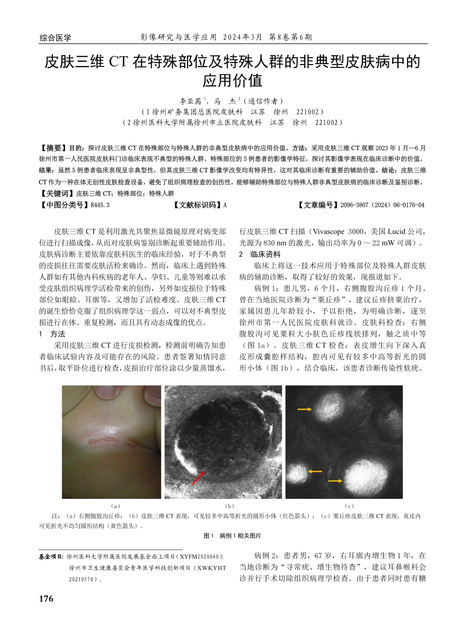 皮肤三维CT在特殊部位及特殊人群的非典型皮肤病中的应用价值.pdf_第1页