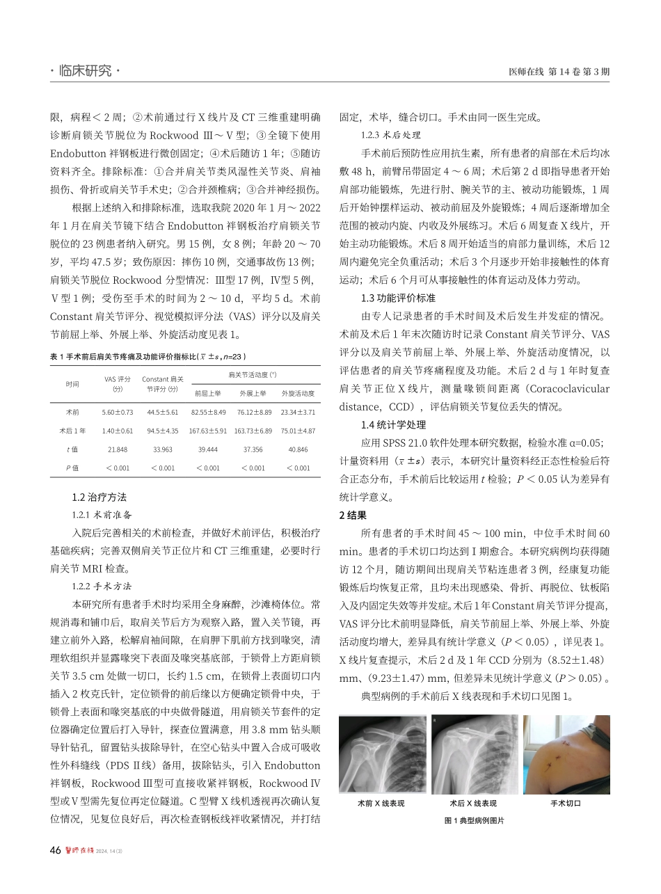 肩关节镜下结合Endobutton袢钢板治疗肩锁关节脱位的疗效分析.pdf_第2页