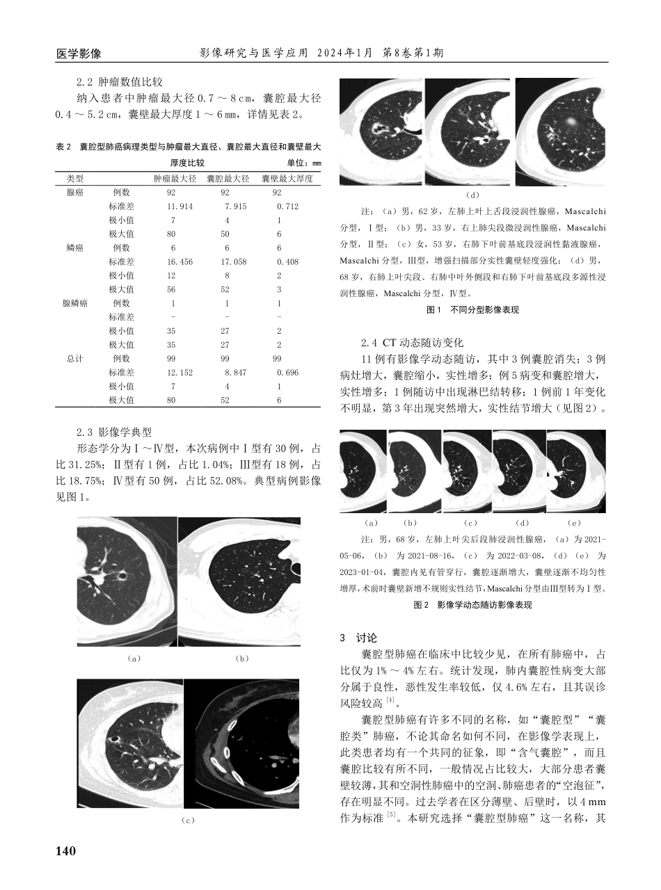 囊腔型肺癌96例影像分析及相关文献学习.pdf_第2页