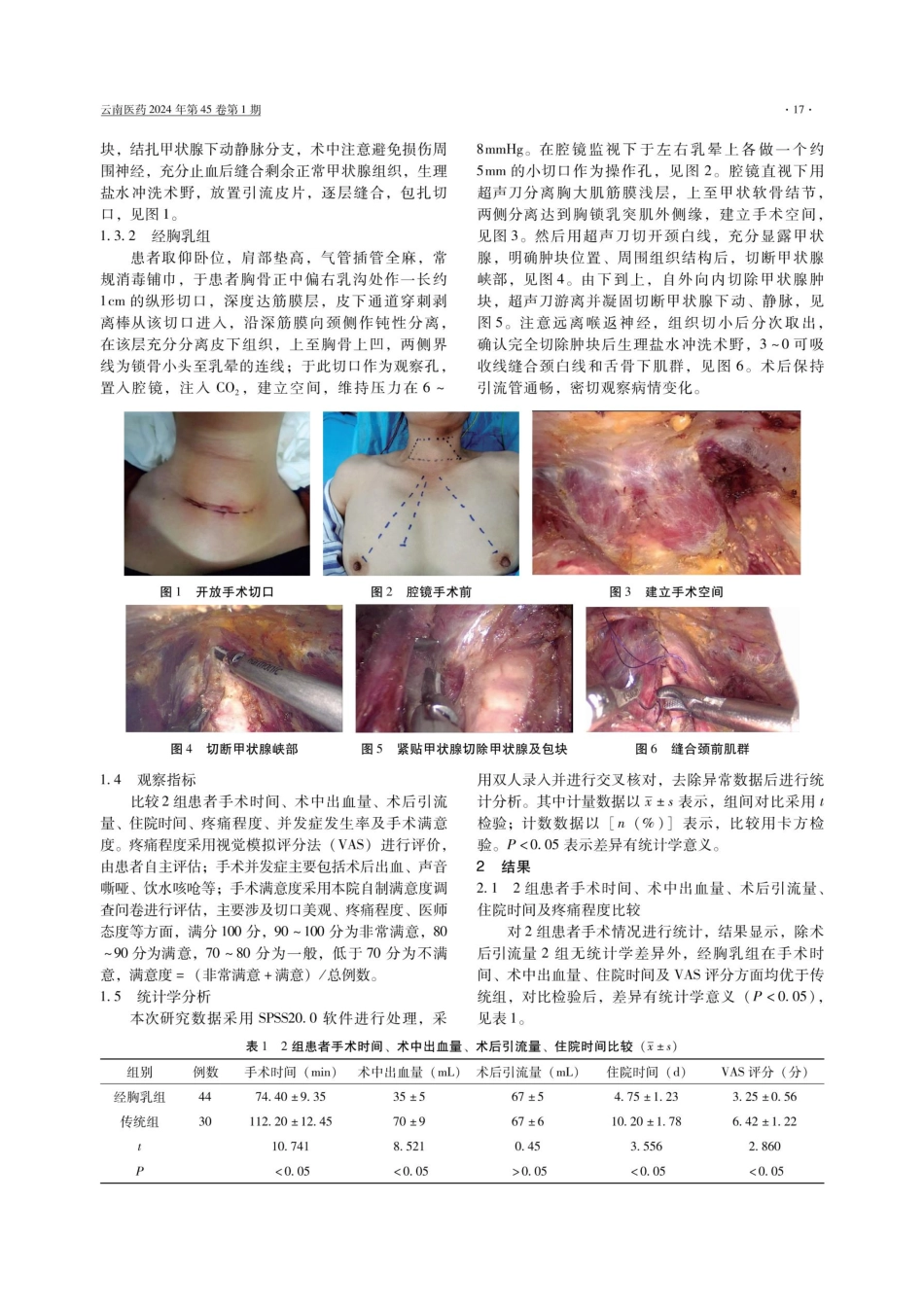 腔镜下甲状腺手术的疗效与方法学.pdf_第3页