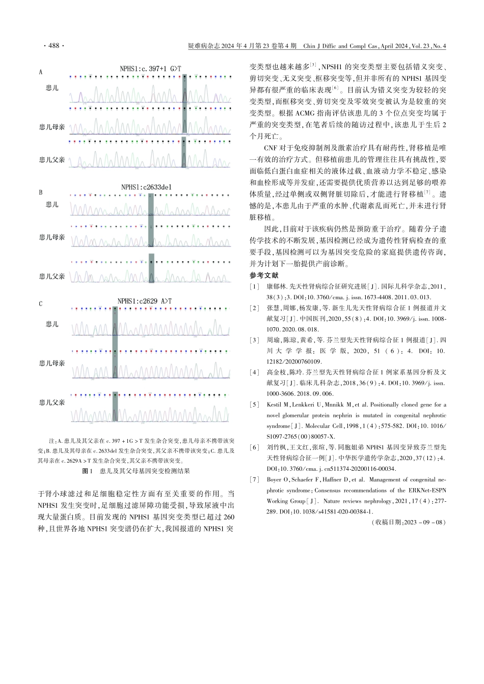 芬兰型先天性肾病综合征1例并文献复习.pdf_第2页