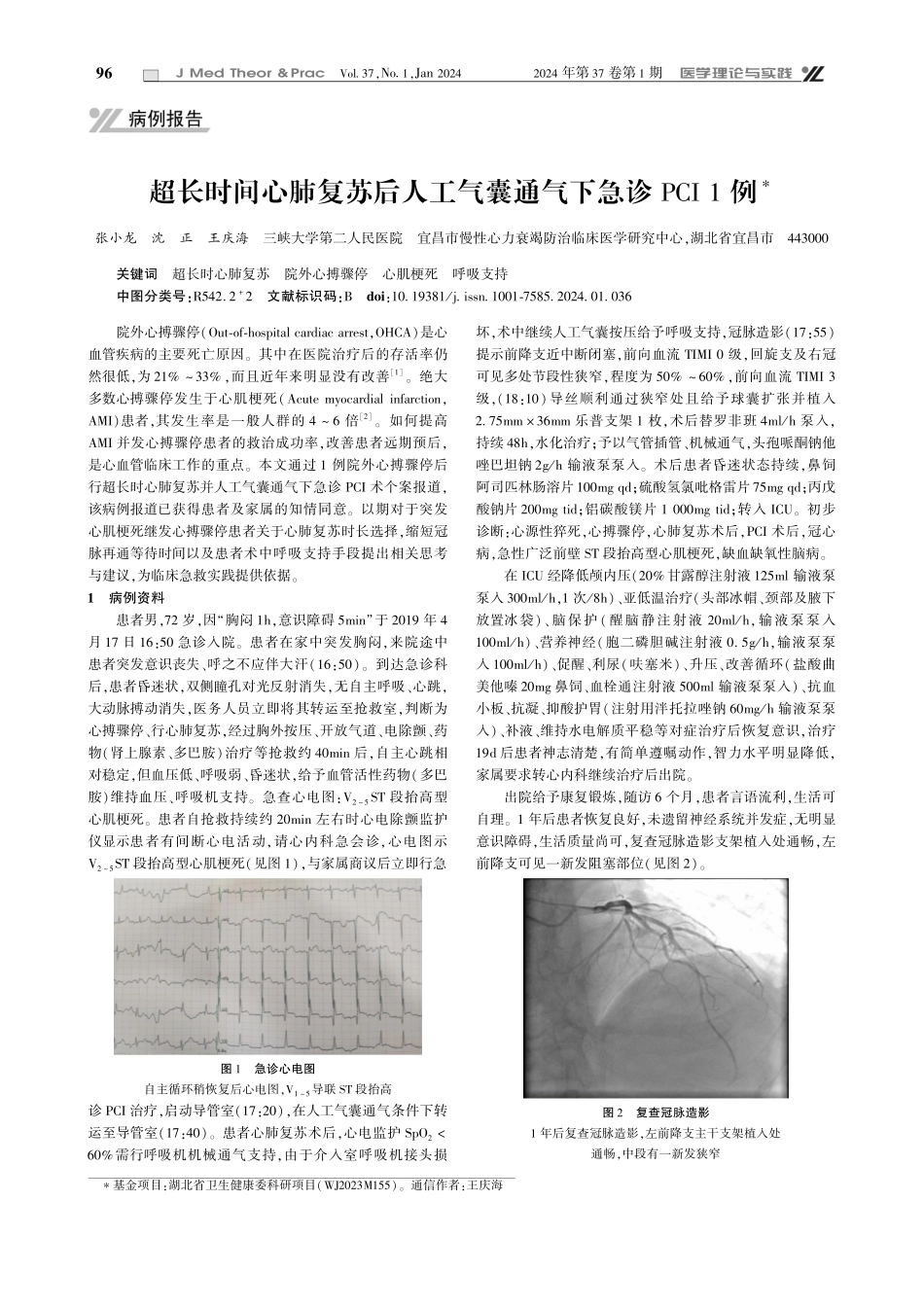超长时间心肺复苏后人工气囊通气下急诊PCI 1例.pdf_第1页