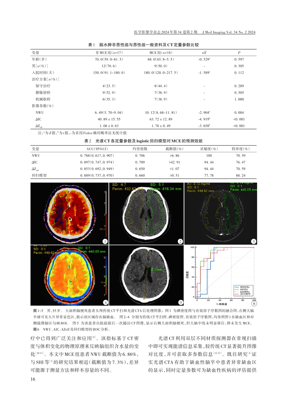 光谱CT在超急性期预测大面积脑梗死患者恶性脑水肿发生的价值.pdf_第3页