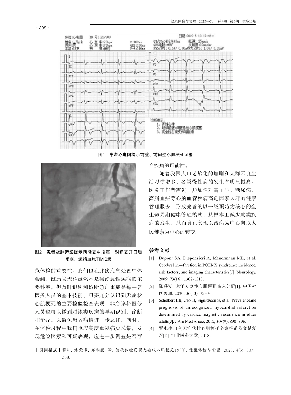 健康体检发现无症状心肌梗死1例.pdf_第2页