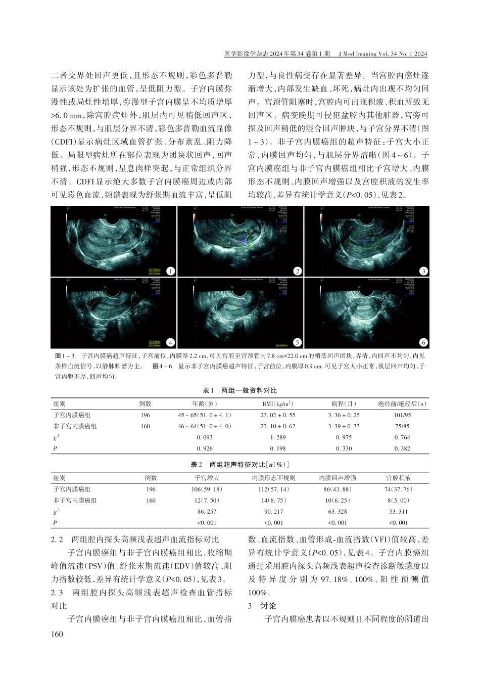 高频浅表超声检查诊断子宫内膜癌的临床价值.pdf_第2页