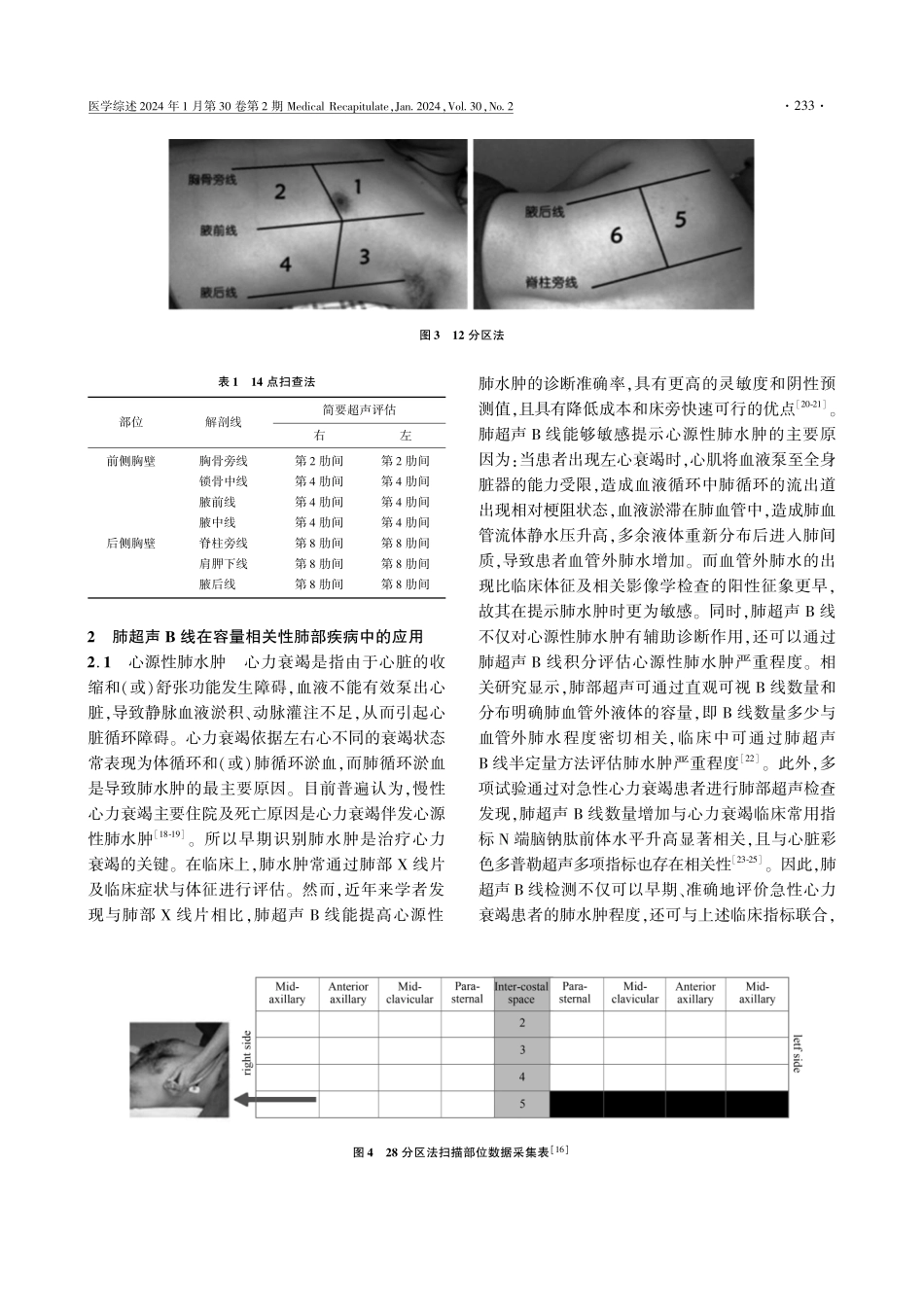 肺超声B线在容量相关性肺部疾病中的应用进展.pdf_第3页