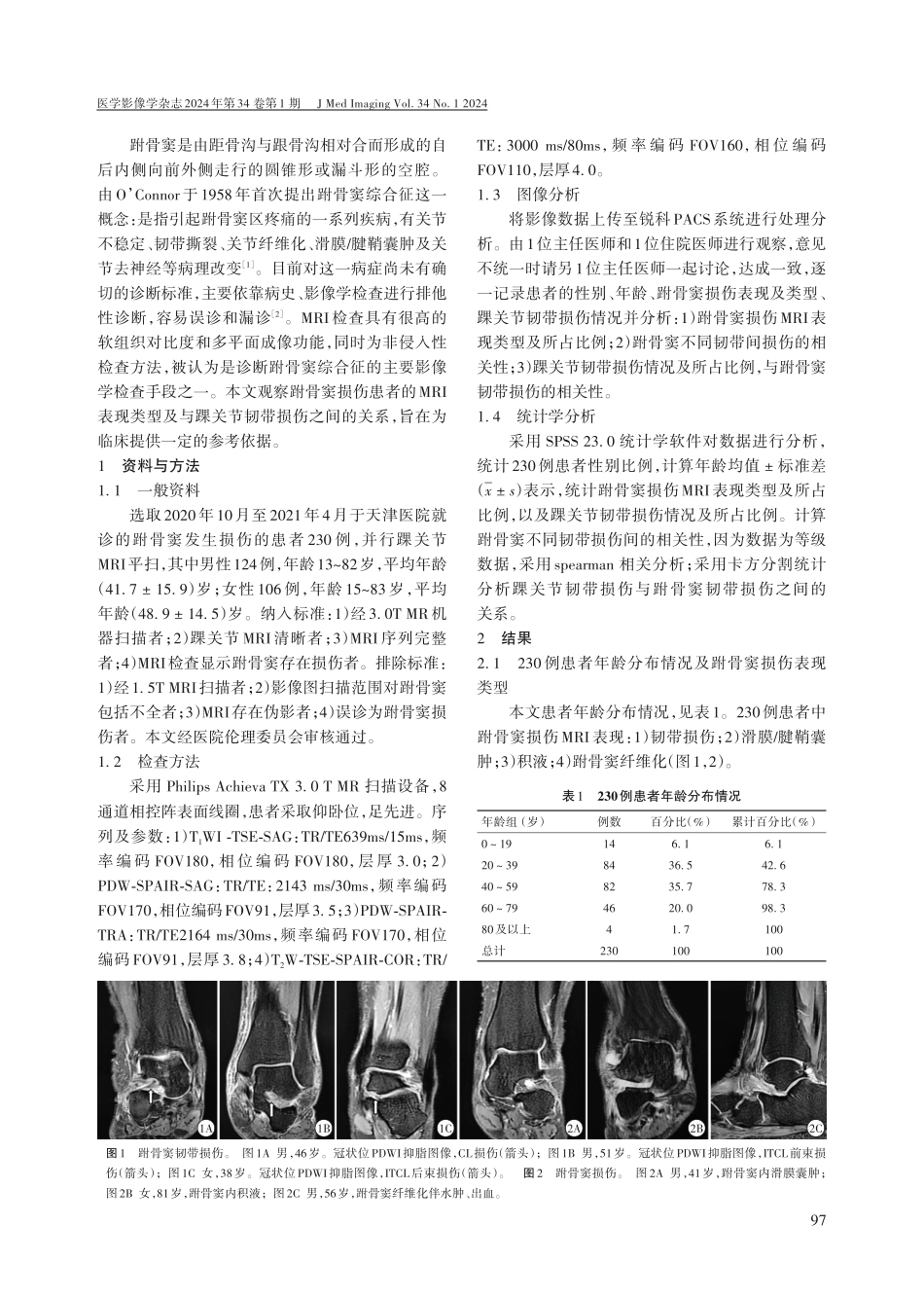 跗骨窦损伤类型及与踝关节韧带损伤关联性的MRI检查分析.pdf_第2页