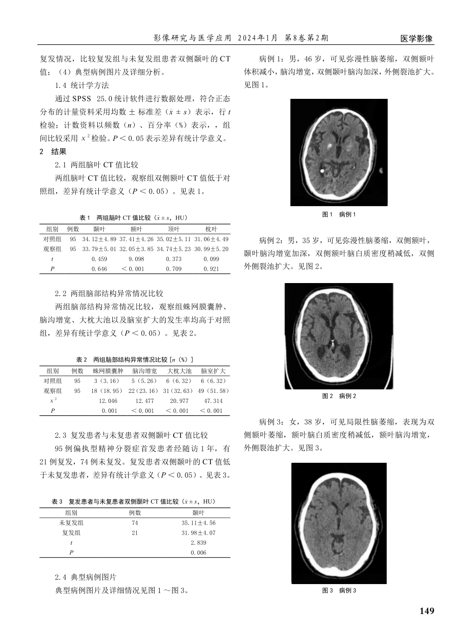 偏执型精神分裂症首发患者的CT影像学特征分析.pdf_第2页