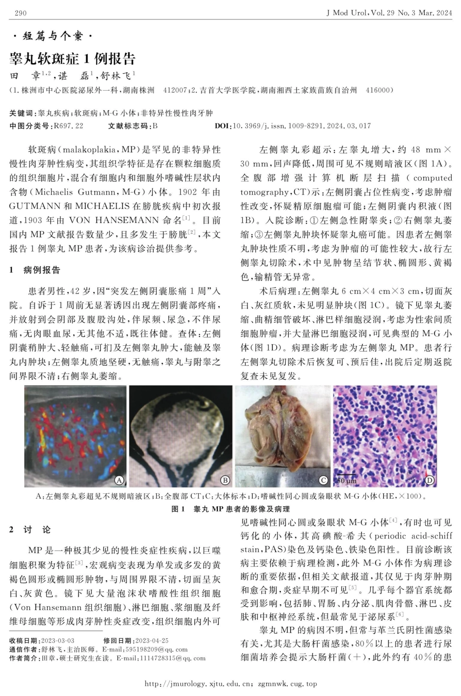 睾丸软斑症1例报告.pdf_第1页