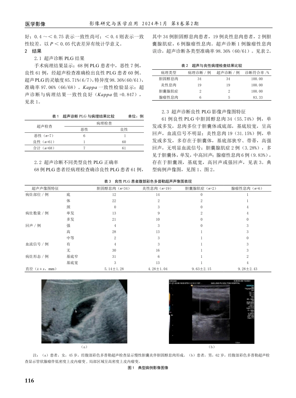 经腹部彩色多普勒超声对良性胆囊息肉样病变的诊断价值.pdf_第2页