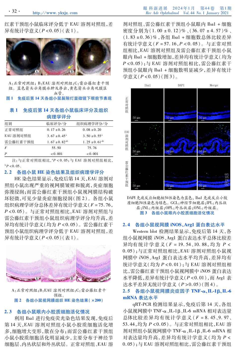 雷公藤红素在实验性自身免疫性葡萄膜炎%28EAU%29小鼠眼组织中的抗炎作用及其对小胶质细胞极化的影响.pdf_第3页