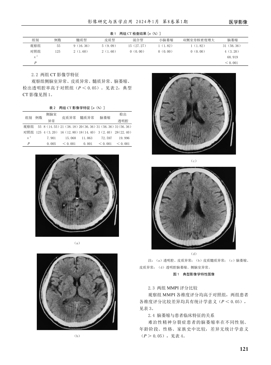 颅脑CT在难治性精神分裂症患者中的应用价值及影像学特征分析.pdf_第2页