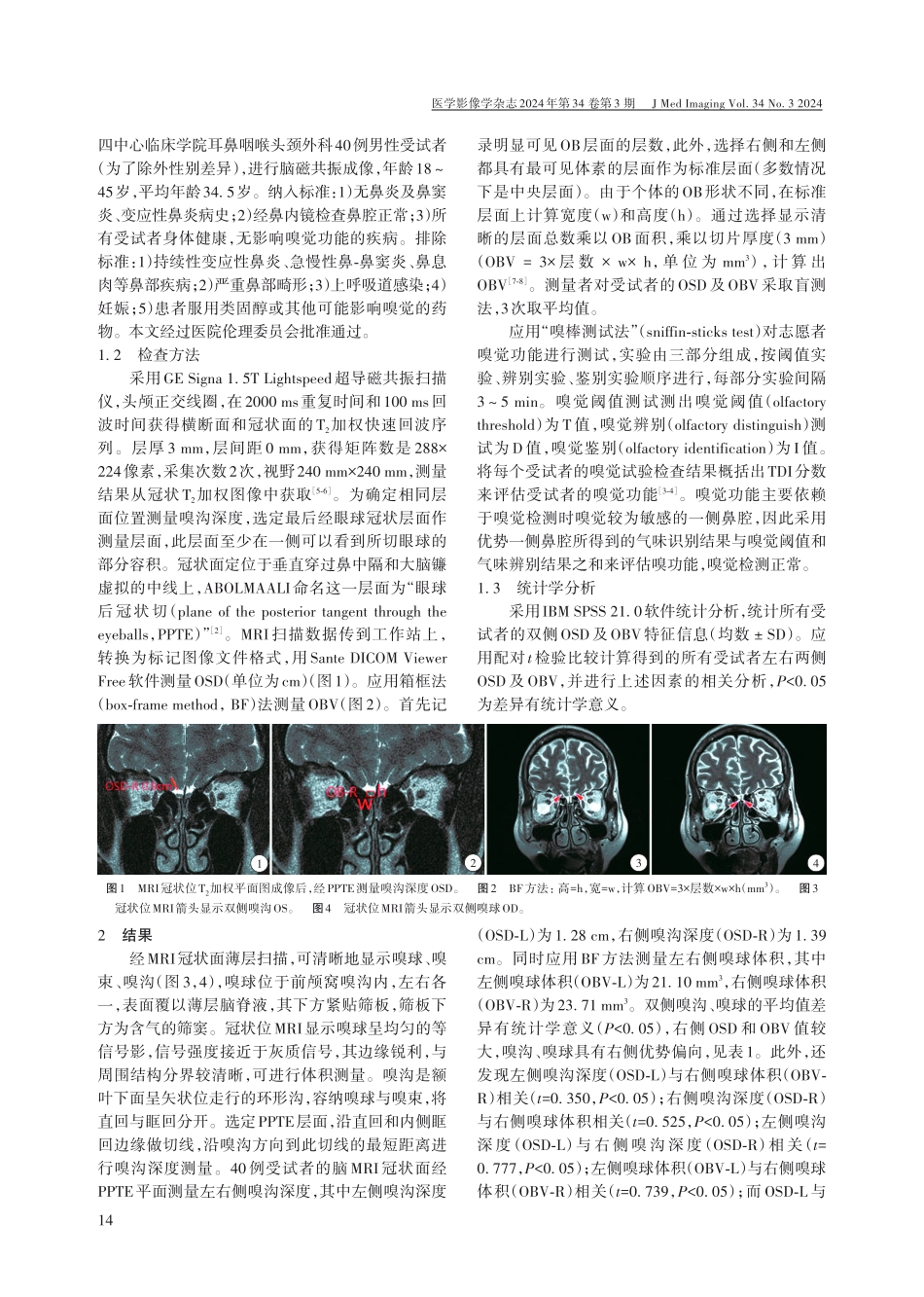 脑磁共振成像嗅沟与嗅球测量分析.pdf_第2页
