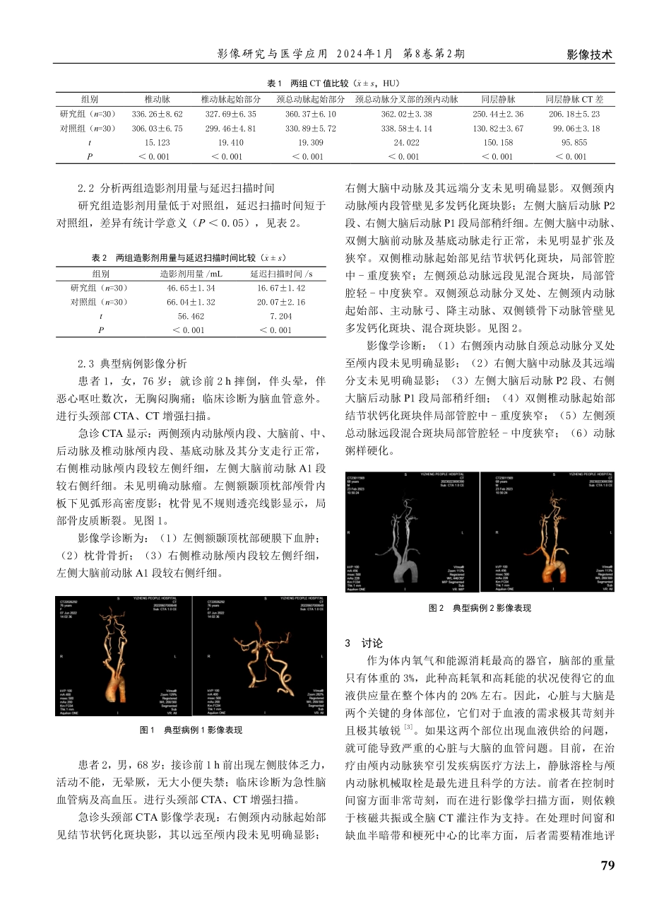 多排螺旋CT头颈联合CTA扫描头颈部血管疾病的应用价值.pdf_第2页