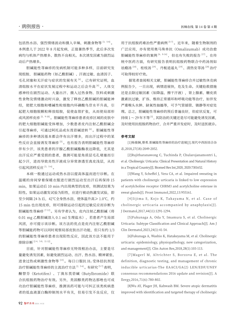 儿童胆碱能性荨麻疹并发过敏性休克一例.pdf_第2页