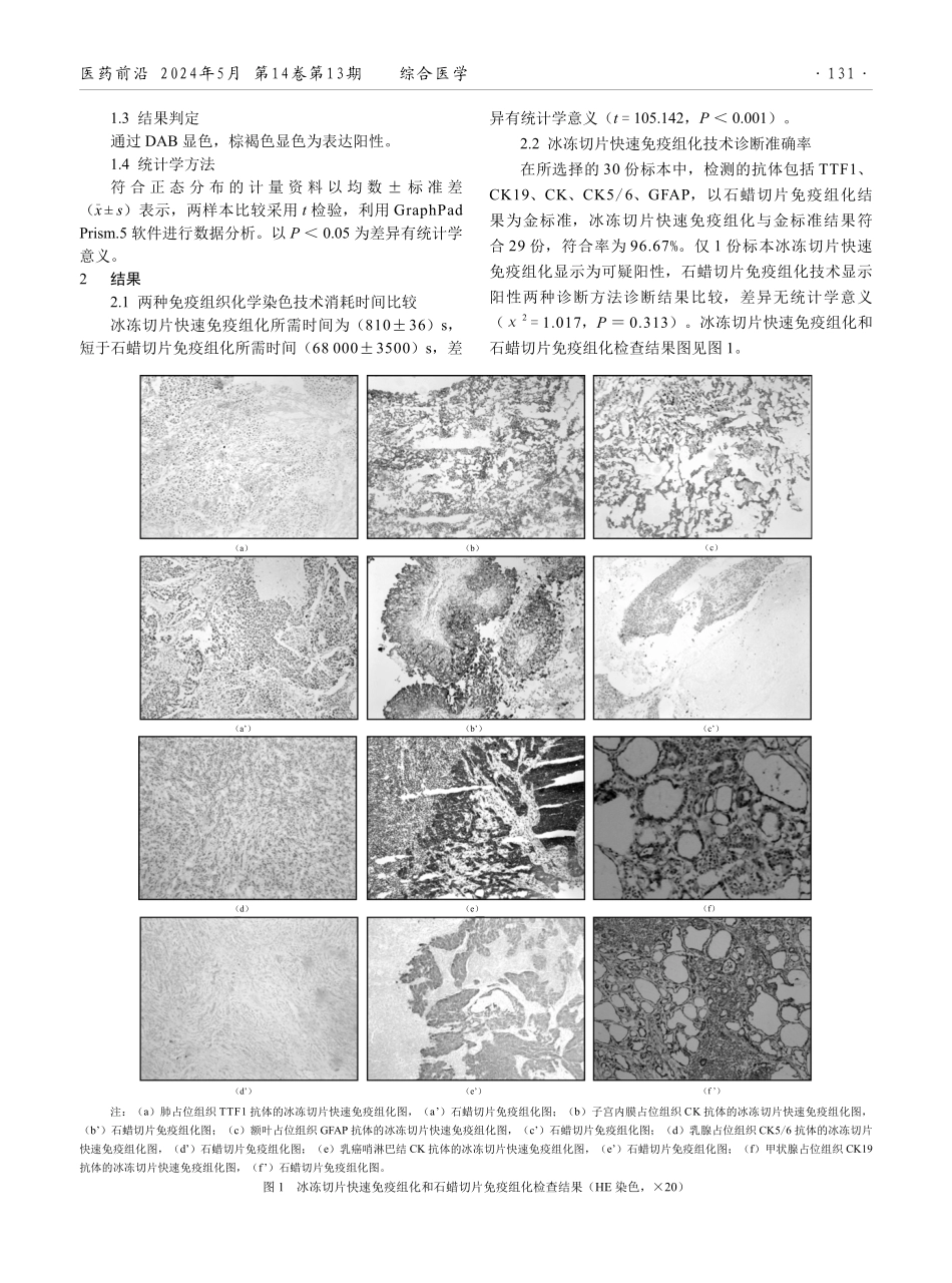 术中冰冻切片快速免疫组化在恶性肿瘤患者中的诊断价值分析.pdf_第2页