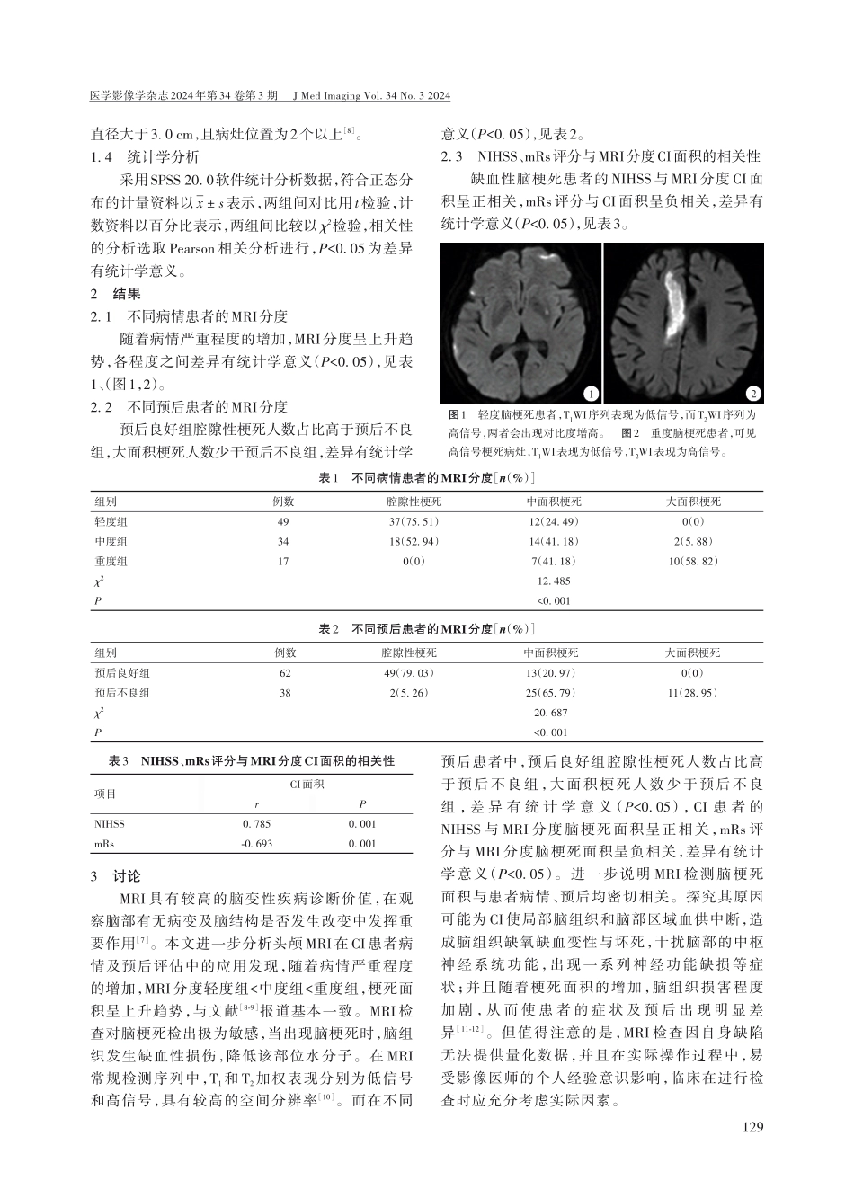 头颅MRI在缺血性脑梗死患者预后评估中的应用价值.pdf_第2页