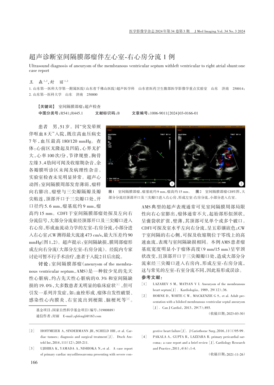 心包黏液样纤维肉瘤术后复发1例.pdf_第2页