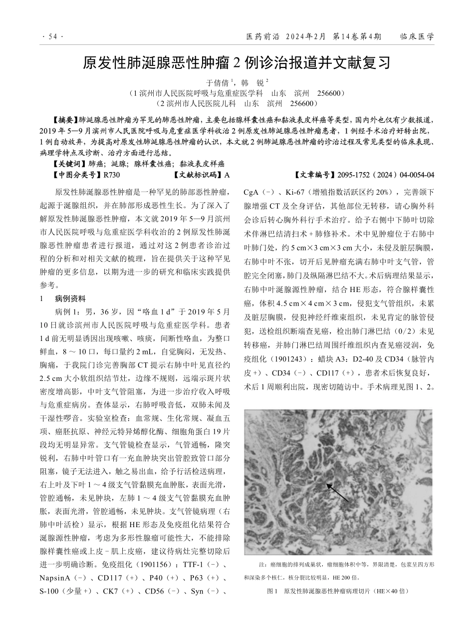 原发性肺涎腺恶性肿瘤2例诊治报道并文献复习.pdf_第1页