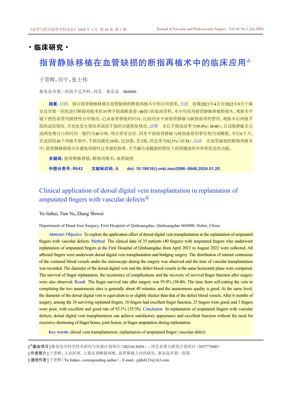 指背静脉移植在血管缺损的断指再植术中的临床应用.pdf_第1页