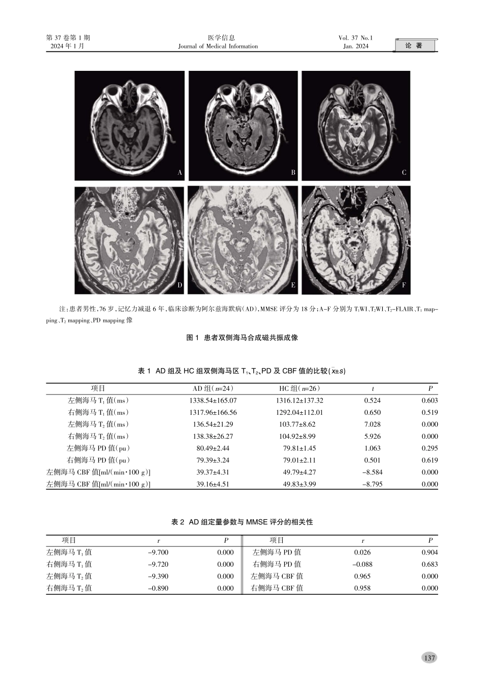 合成MRI联合3D-ASL在阿尔兹海默病诊断中的价值.pdf_第3页