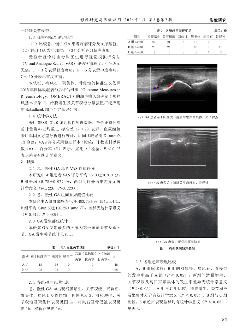 急、慢性痛风性关节炎的肌骨超声表现对比研究.pdf_第2页