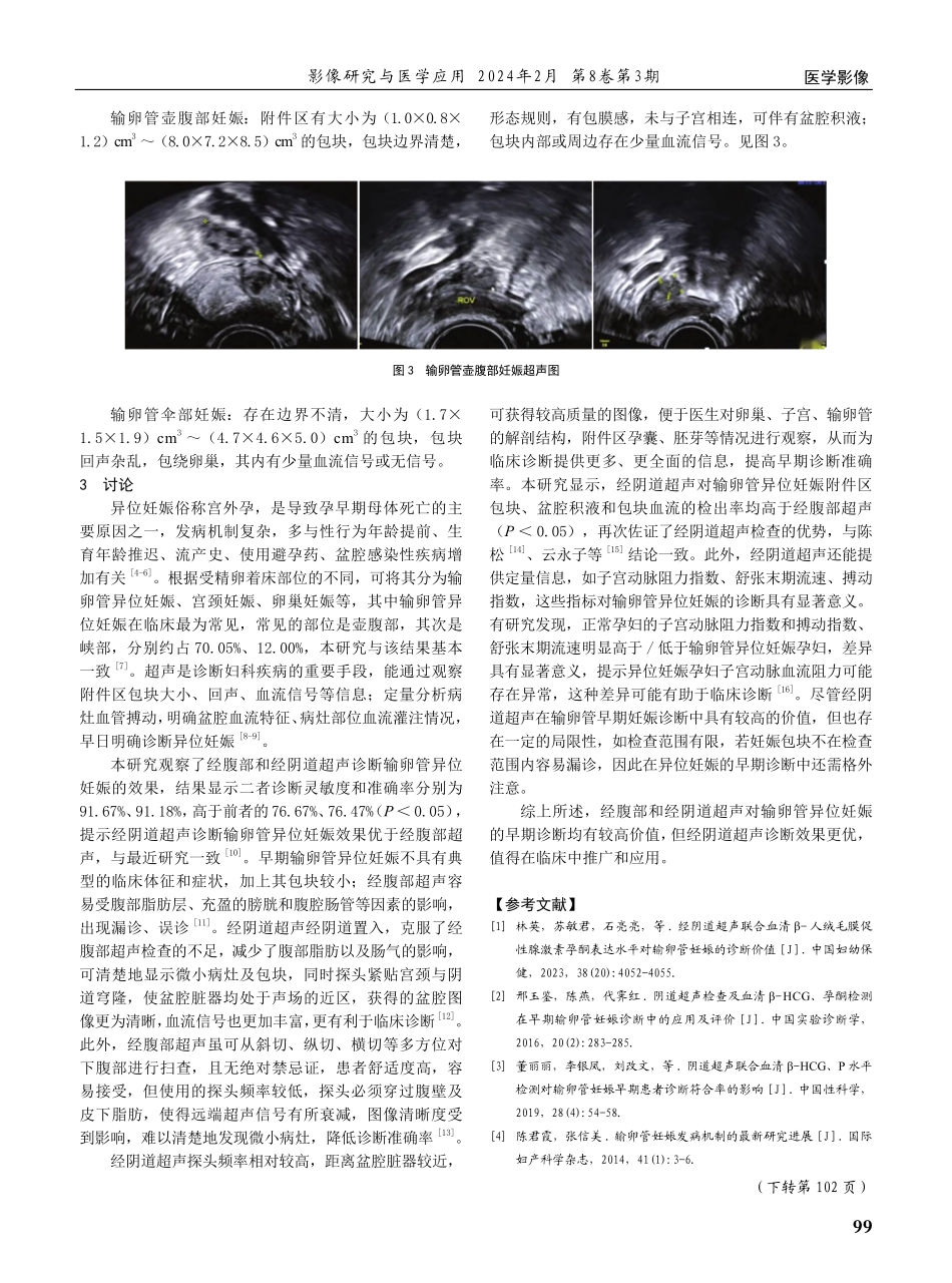 经阴道超声对输卵管异位妊娠的早期诊断价值.pdf_第3页