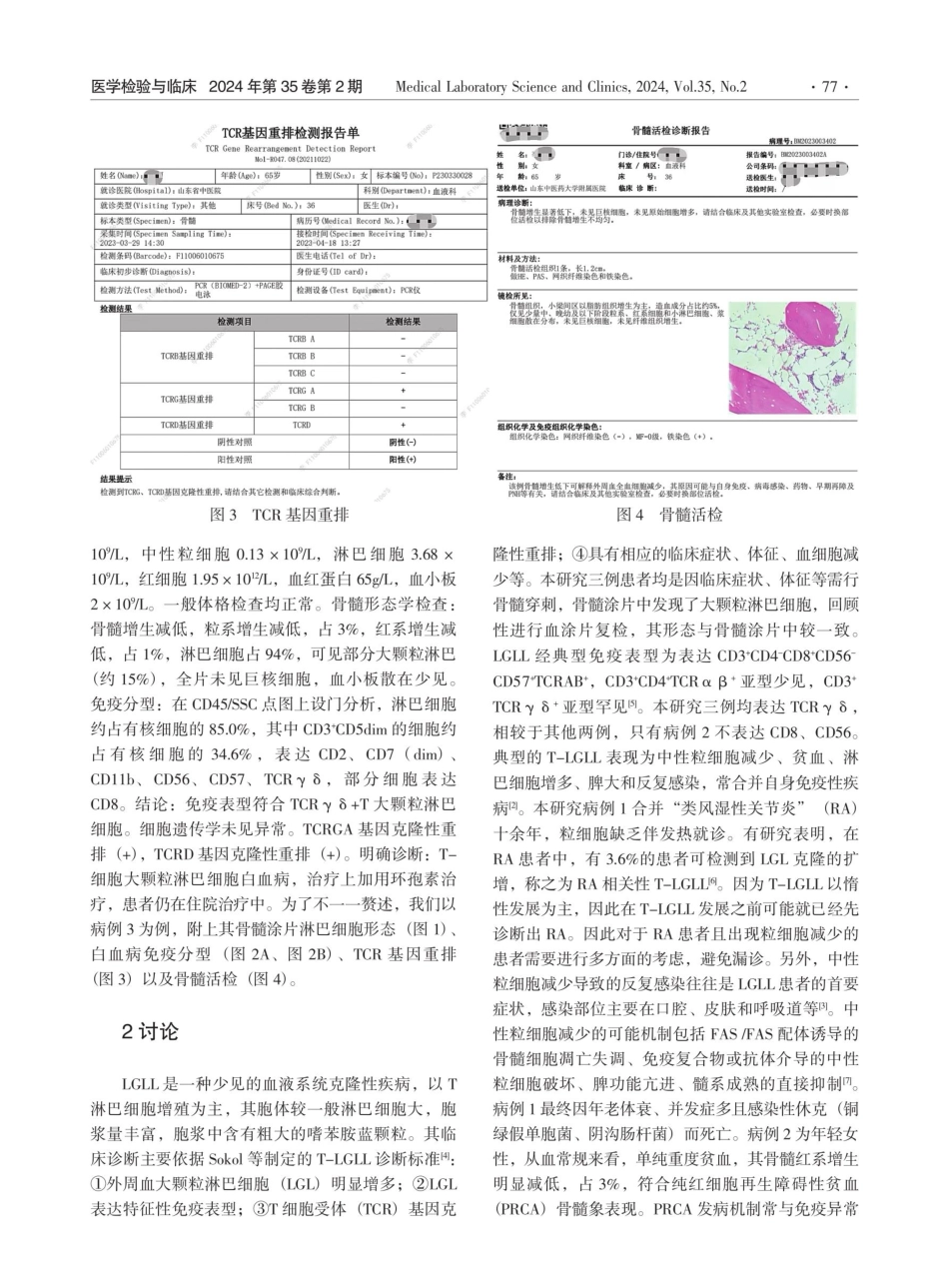 3例T-细胞大颗粒淋巴细胞白血病及文献复习.pdf_第3页