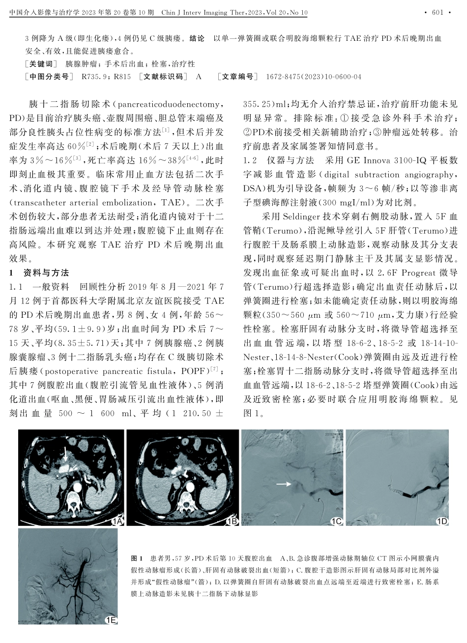 经导管动脉栓塞治疗胰十二指肠切除术后晚期出血.pdf_第2页