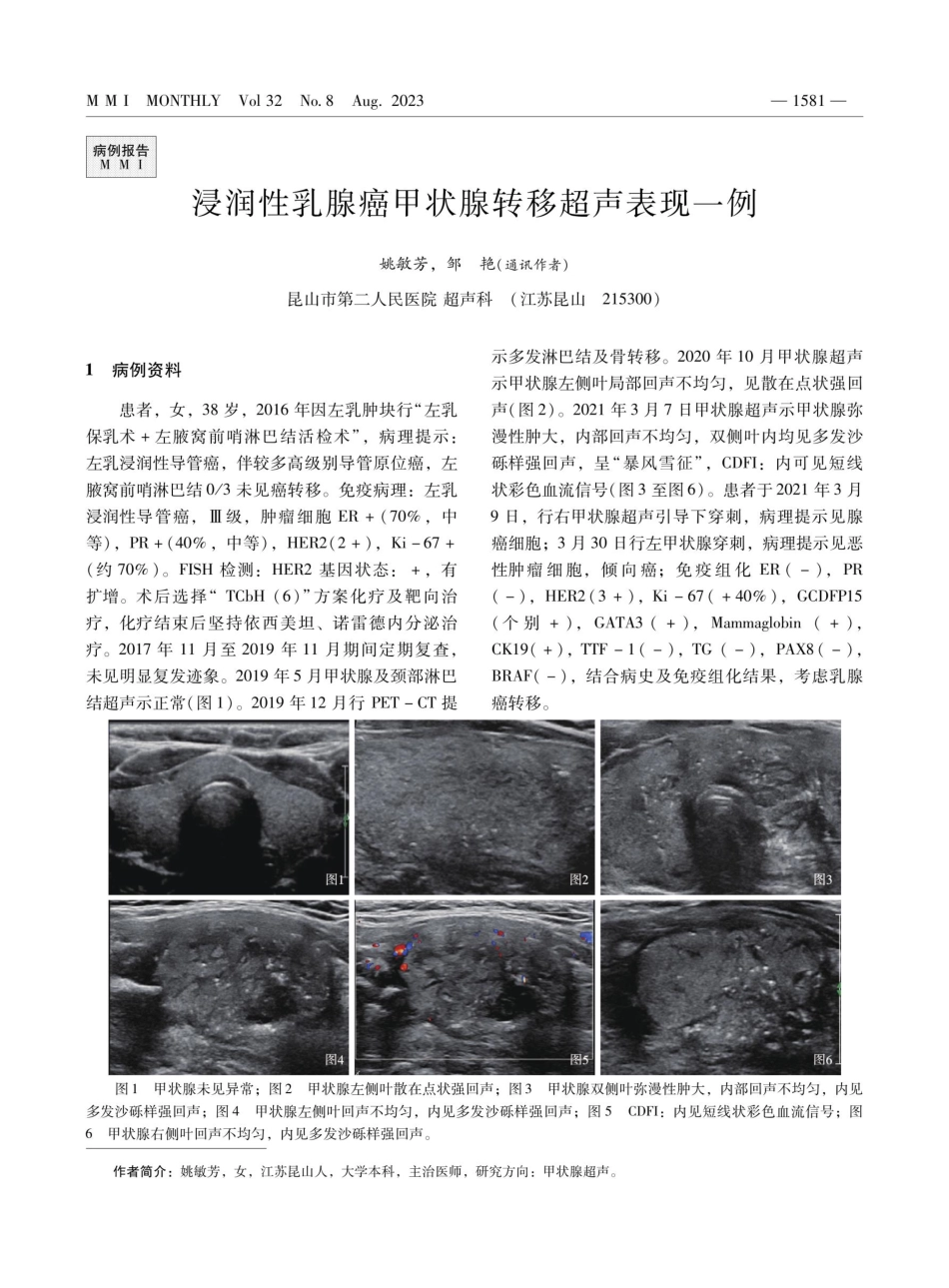 浸润性乳腺癌甲状腺转移超声表现一例.pdf_第1页
